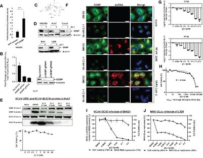 Oxysterole-binding protein targeted by SARS-CoV-2 viral proteins regulates coronavirus replication